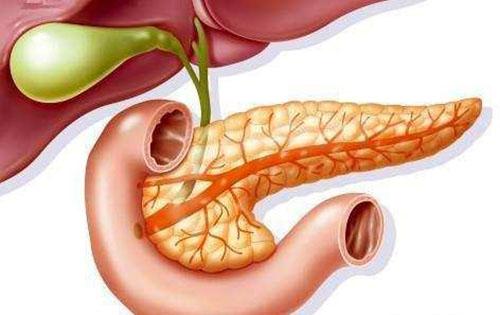 怎么会得急性胰腺炎 急性胰腺炎是咋引起来的