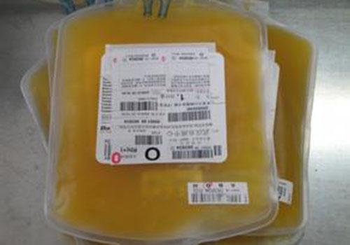 献血浆对人体有害吗（献血浆对人身体有没有害）