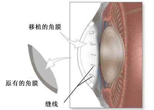 眼角膜是什么（眼角膜是什么样子）