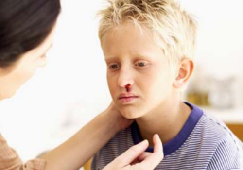 流鼻血是什么原因（流鼻血是什么原因小孩 怎么治）