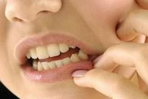 智齿牙龈肿痛可以吃阿莫西林吗（智齿牙龈发炎肿痛能吃阿莫西林吗）