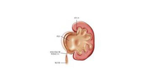 肾积水有哪些症状（肾积水有哪些症状 男性）