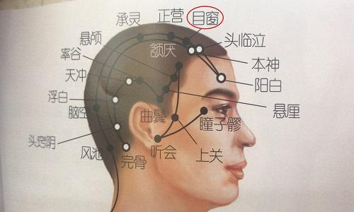 目窗的准确位置图 目窗的准确位置图找法