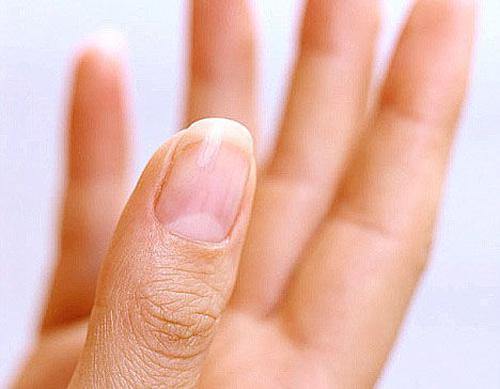 指甲上只有大拇指有月牙代表什么 大拇指甲上有月牙是怎么回事