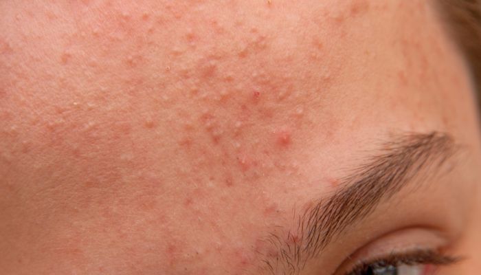 护肤品混搭对肌肤有什么伤害 护肤品混搭对肌肤有伤害吗