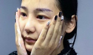 敏感肌和过敏肌的区别 敏感肌和过敏体质的区别
