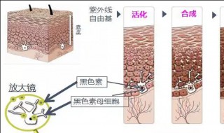 皮肤黑色素怎么去掉（皮肤黑色素怎么去掉图片）