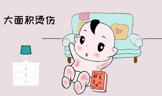 开始开水烫最佳的处理方法 开水烫后处理方法