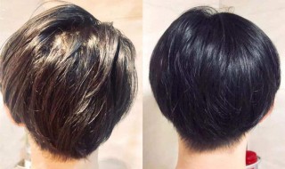 怎么去头油（不用洗发水怎么去头油）