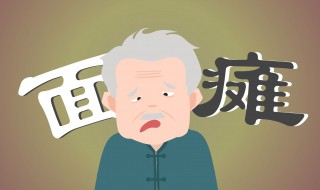 面瘫是什么 面瘫是什么原因引起的