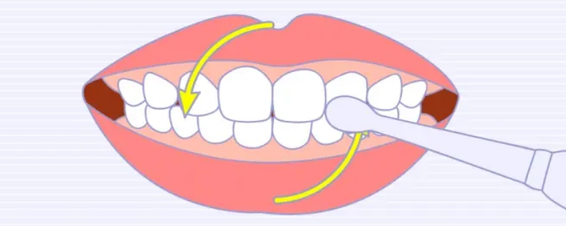 圆弧刷牙法 圆弧刷牙法口诀