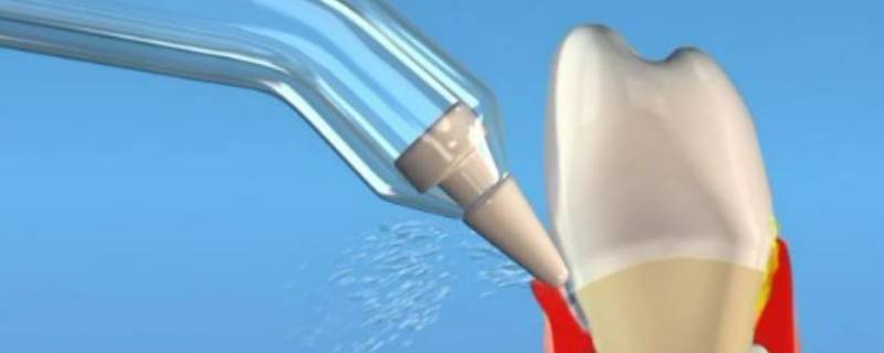 冲牙器是刷牙前用还是刷牙后用 冲牙器先用还是牙刷