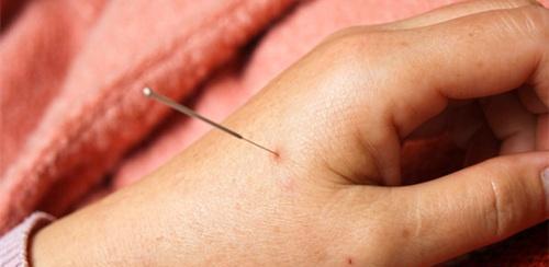 中医养生（中医养生知识）