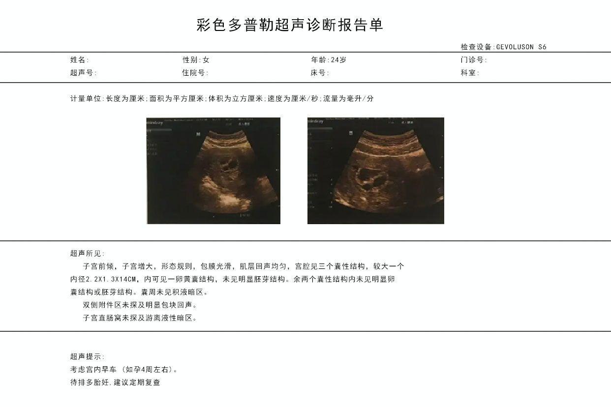 怀孕4周的彩超图片 怀孕4周做彩超