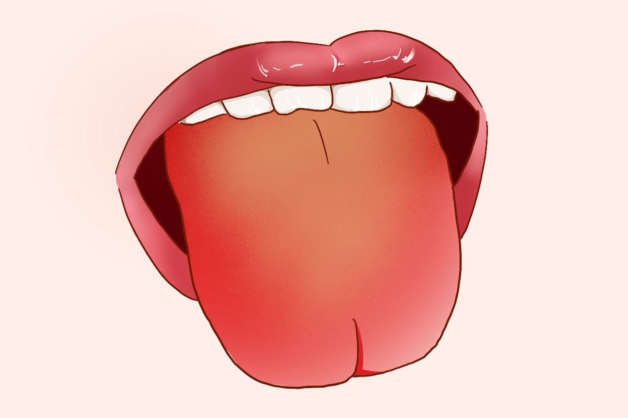 舌红苔黄图片