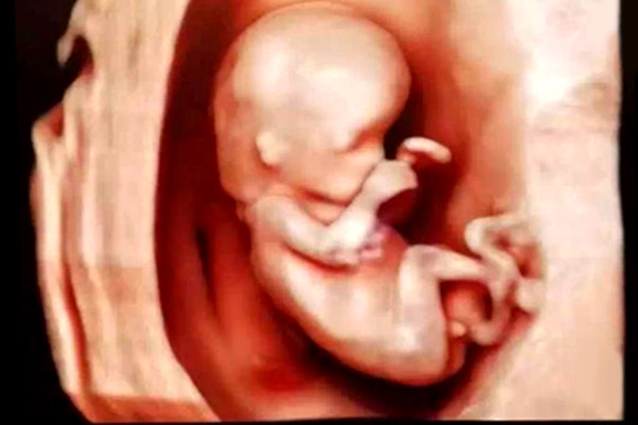 怀孕12周四维彩超图片（孕12周胎儿四维彩超图）