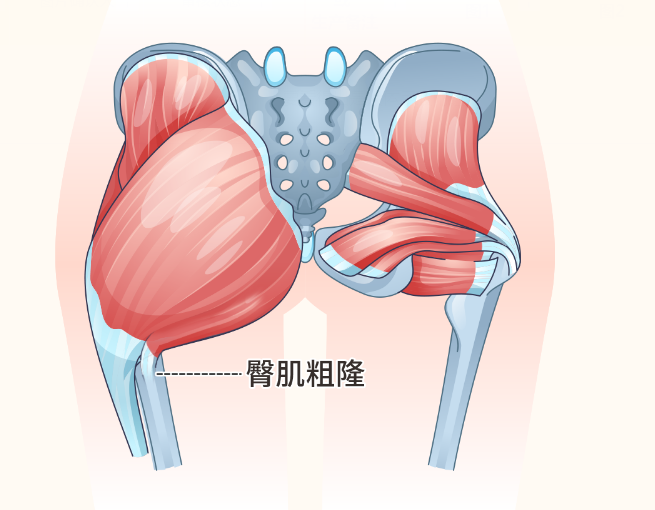 臀肌粗隆在哪个位置图片（臀肌粗隆的位置）