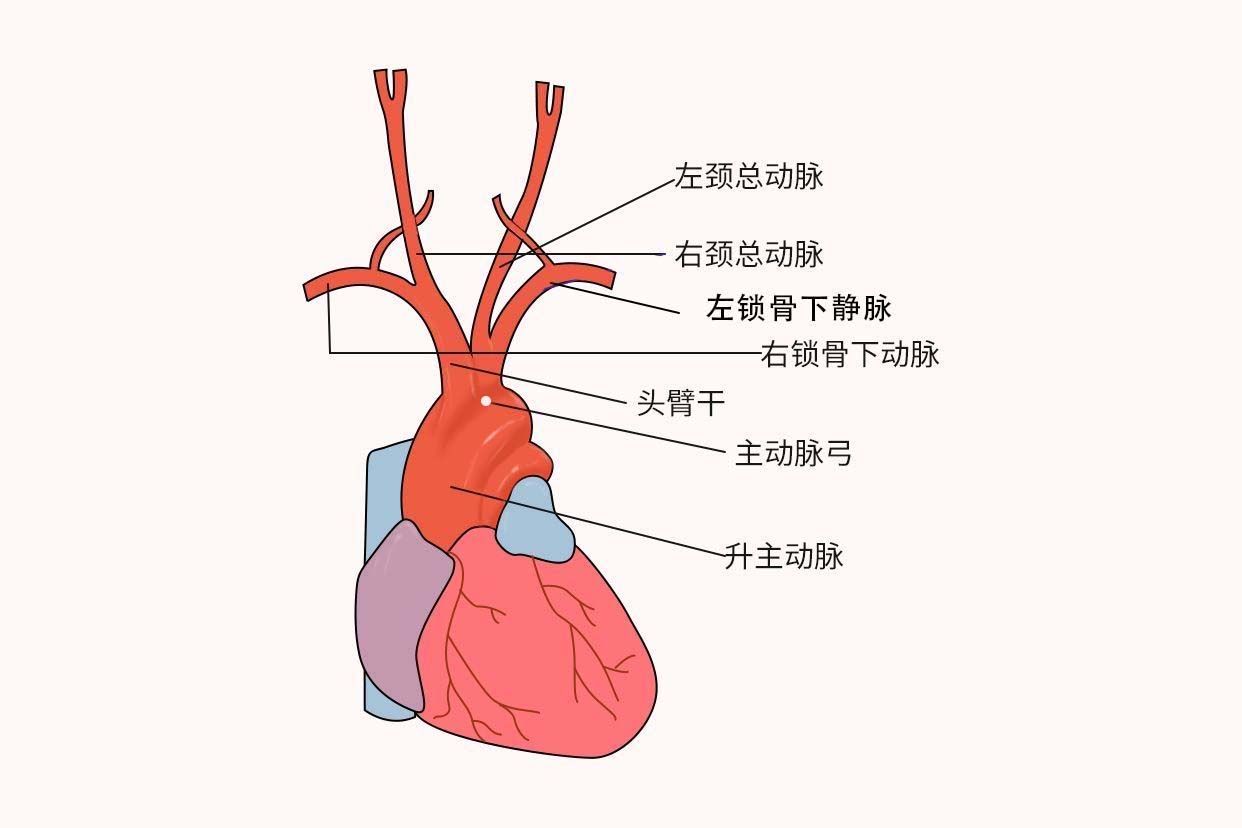 主动脉弓位置示意图 主动脉弓结构示意图