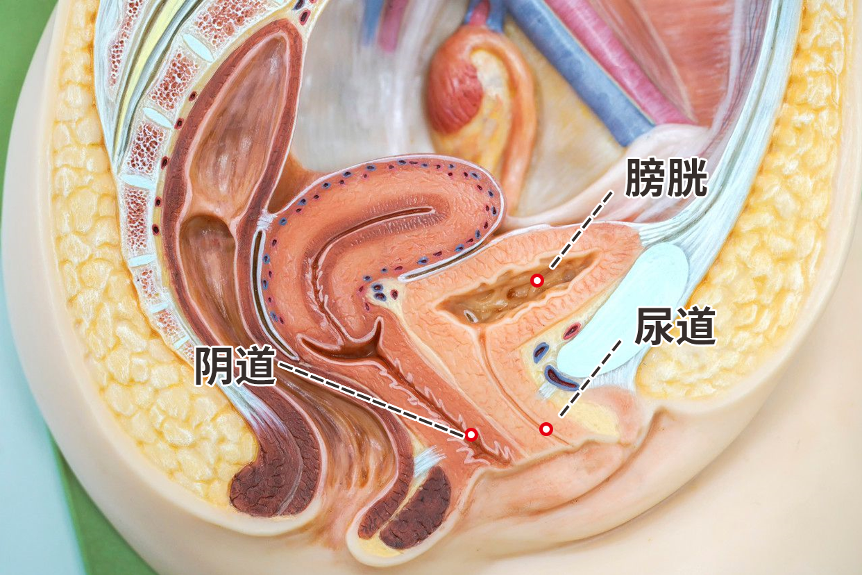 尿道膀胱阴道图（尿道膀胱位置图）