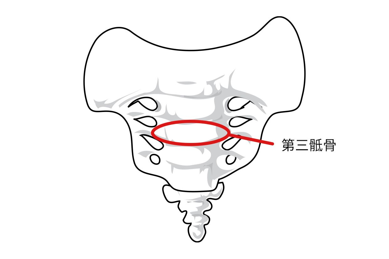 第三骶骨在哪个位置图片