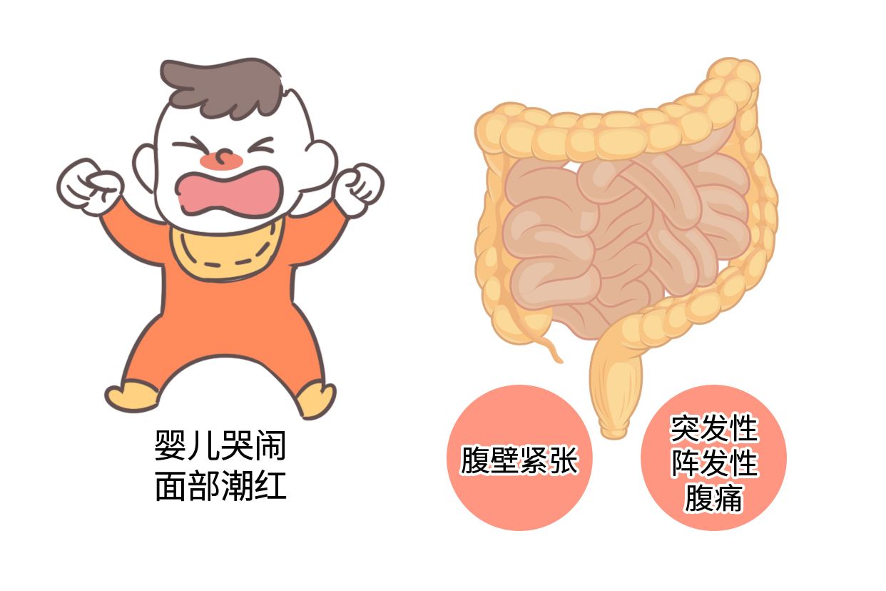 肠痉挛图片 肠痉挛图片像什么样子