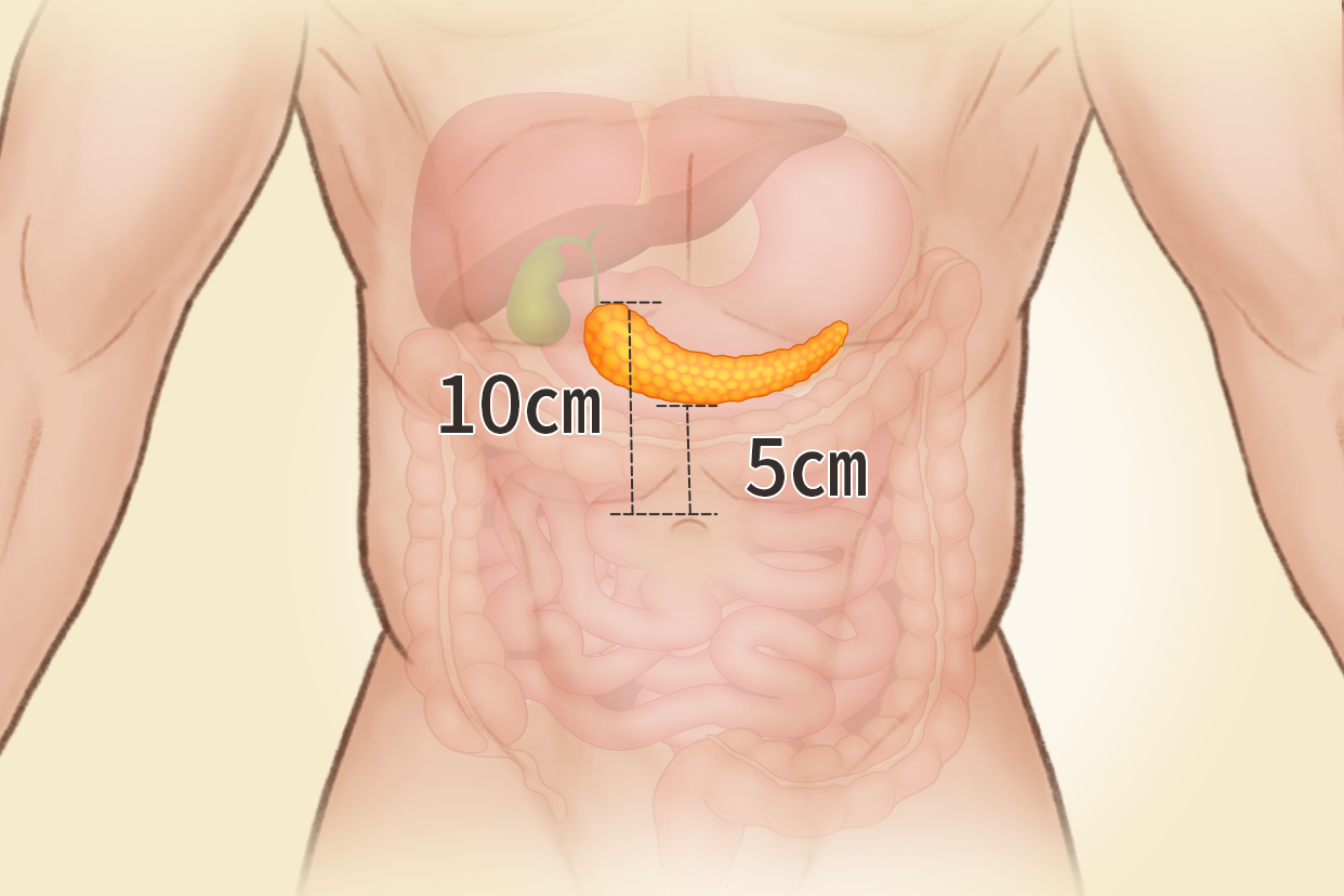 胰腺体表投影区位置图 胰腺体在哪个位置图