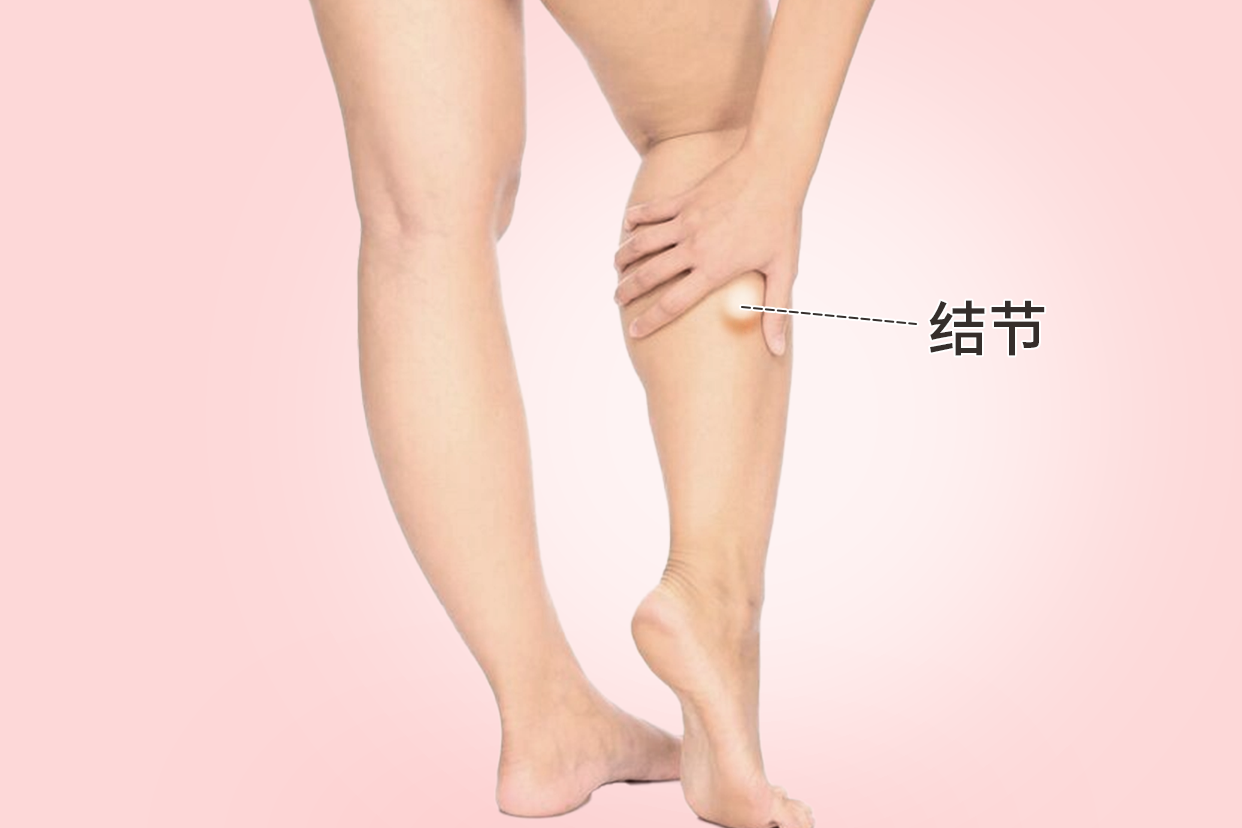 女人右小腿外侧结节图片 小腿内侧有节结