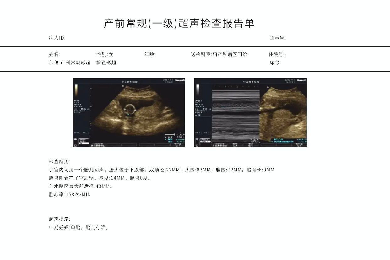 产科超声检查报告图解