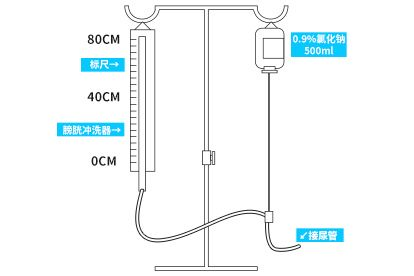 测量膀胱压的流程图