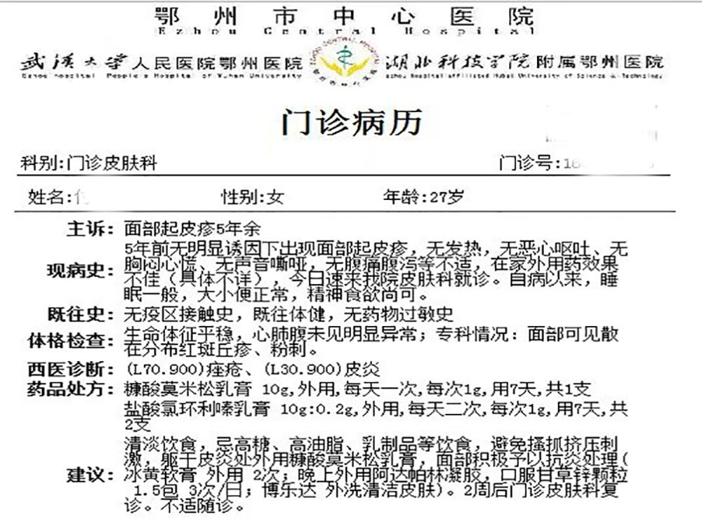 一位女性患有皮炎5年多,外用阿达帕林凝胶临床治愈 一位女性患有皮炎5年多,外用阿达帕林凝胶临床治愈