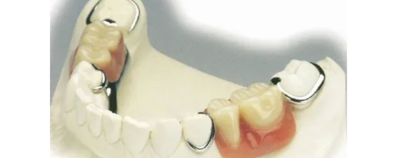 活动假牙咀嚼力能恢复多少（假牙有咀嚼功能吗）