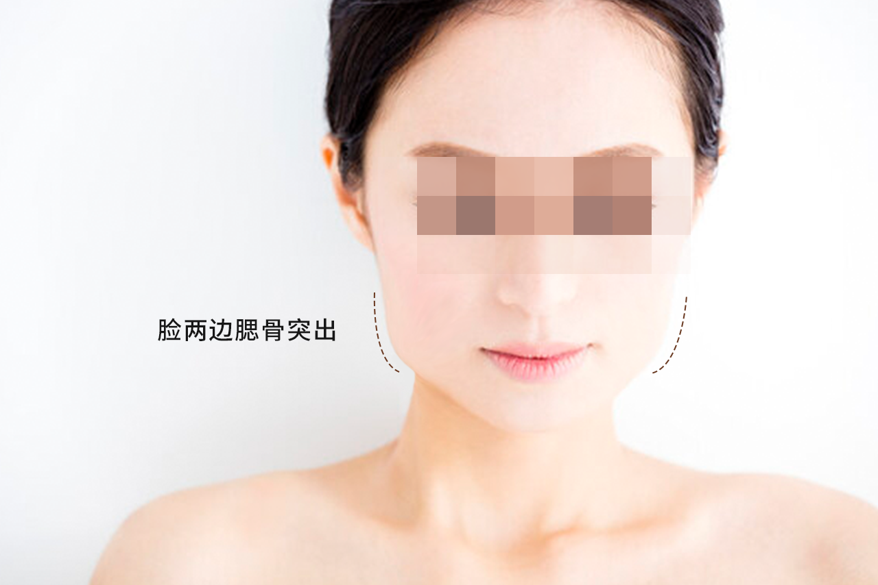 女人脸两边腮骨突出图片（女人脸两边腮骨突出图片）