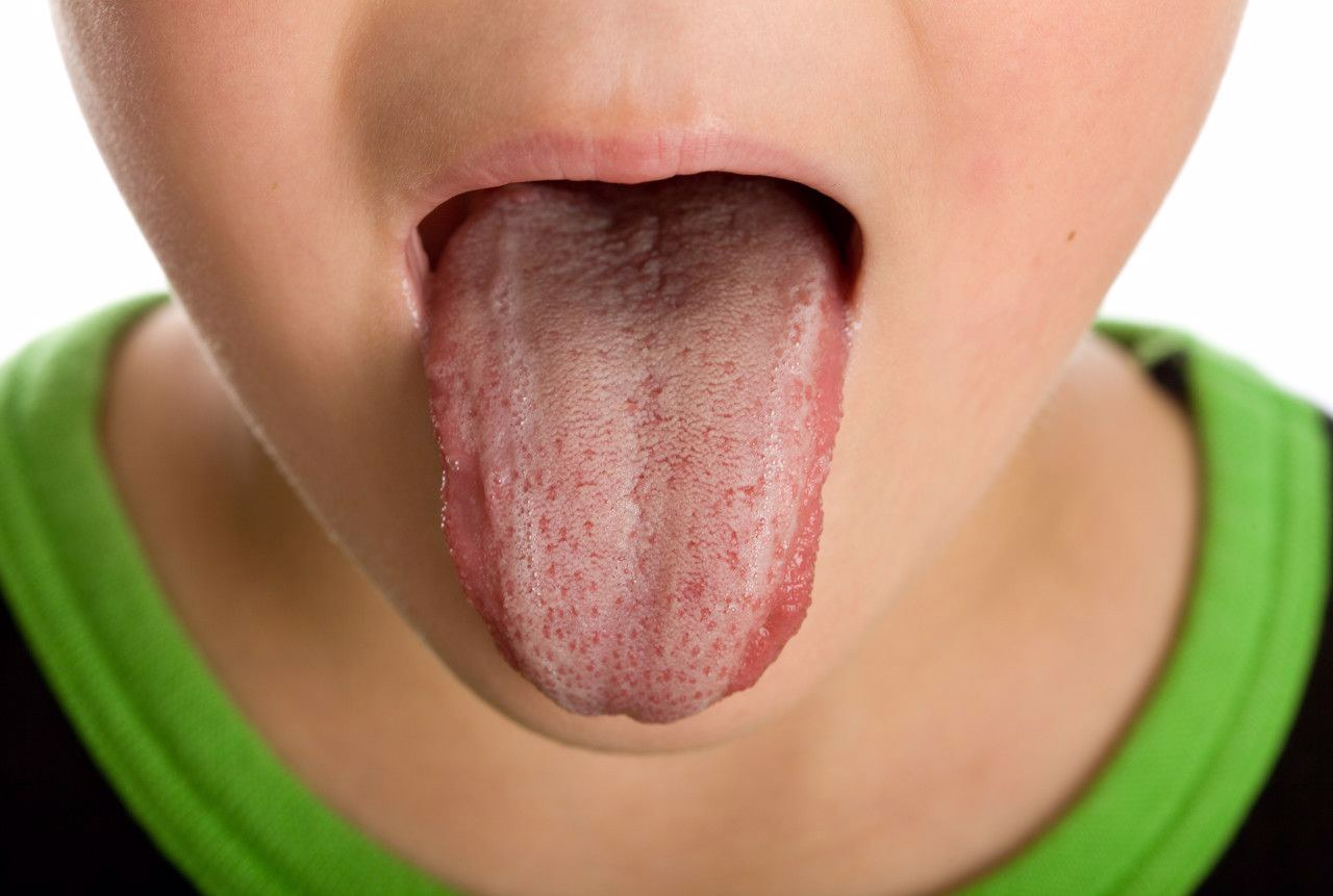 舌头上两边两条竖线图片 舌头上两边两条竖线图片男
