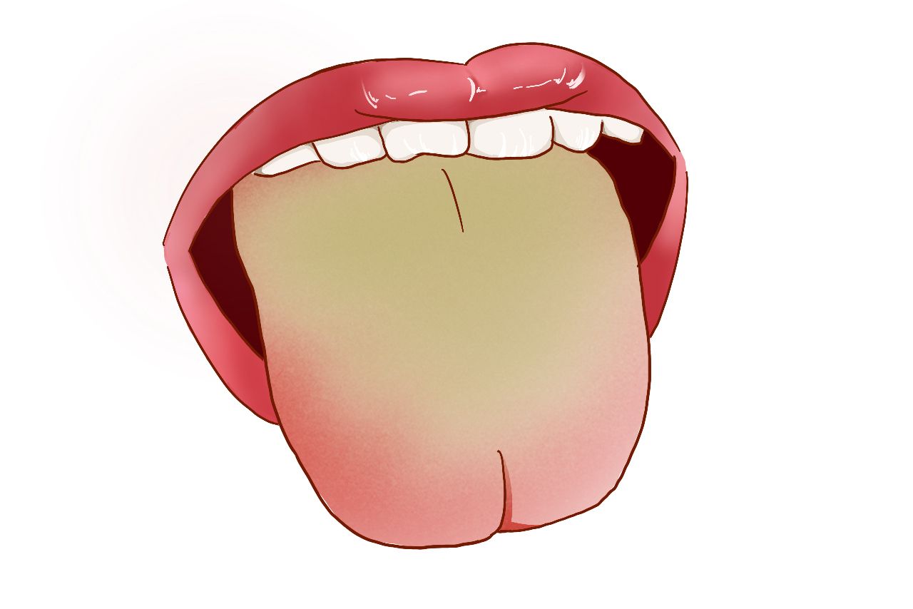 膀胱湿热舌苔图片（膀胱湿热舌苔图片大全）