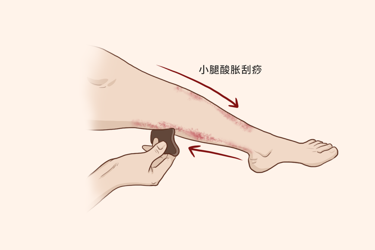 小腿酸胀刮痧的方法示意图（腿发胀发酸刮痧方法）