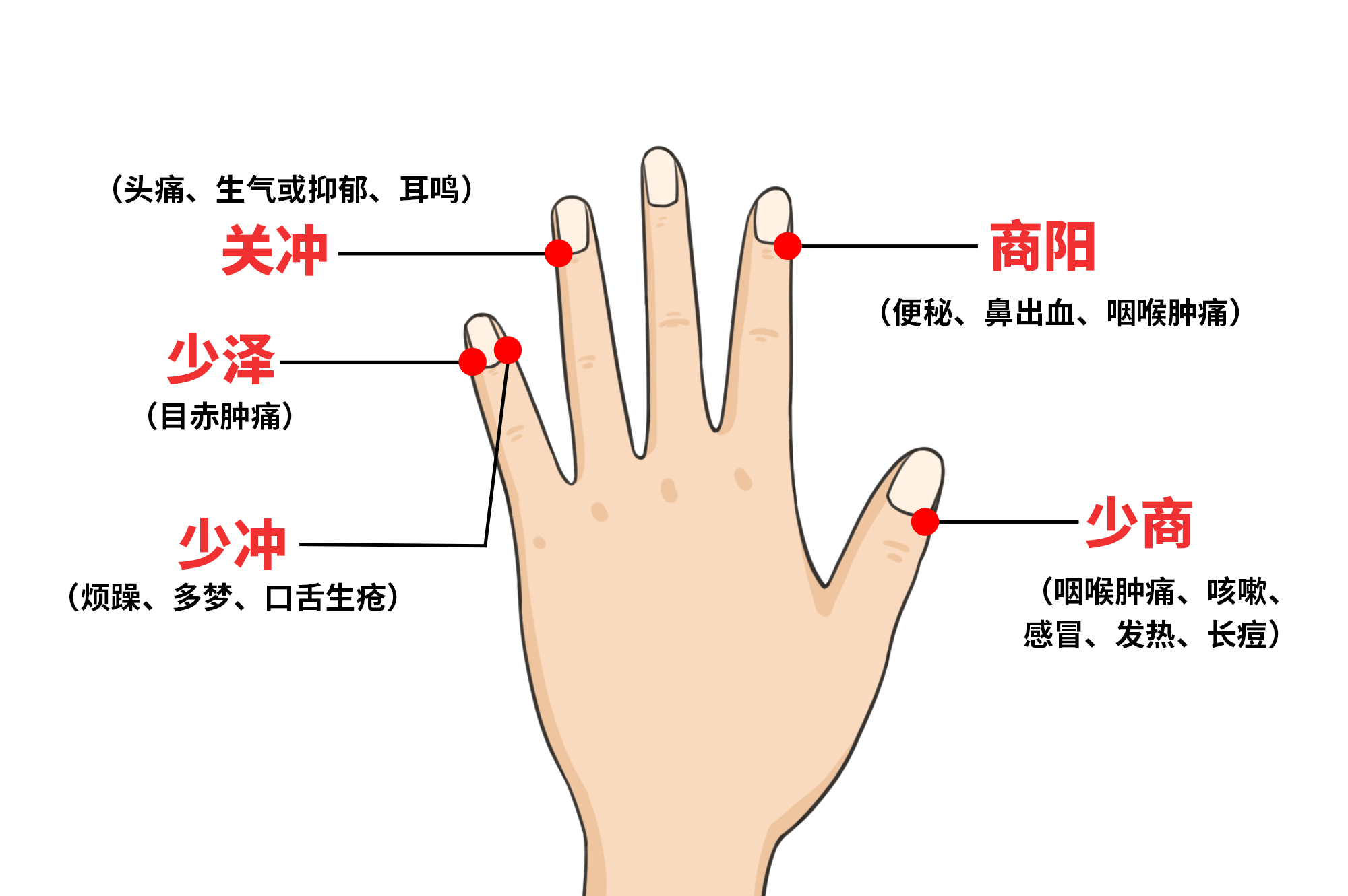 上火手指放血扎什么位置图 扎手指放血去火