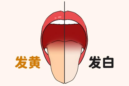 舌苔厚白和厚黄的区别图片
