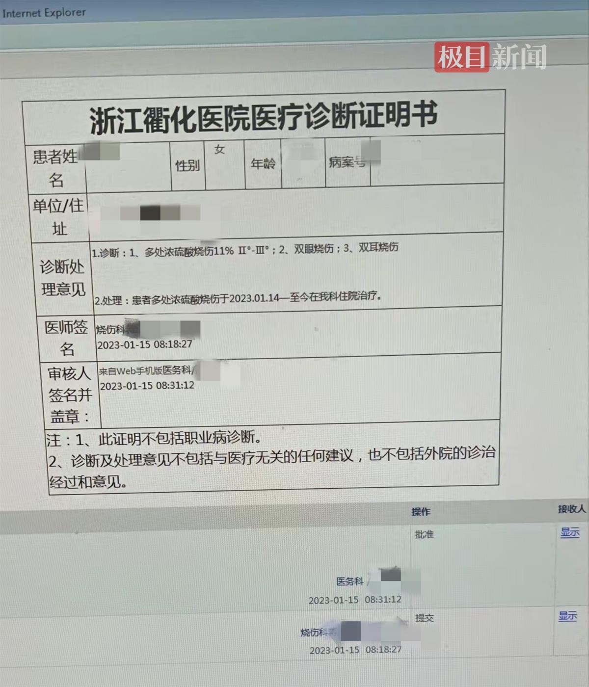 女子遭家暴被丈夫泼硫酸，烧伤科专家：伤情鉴定或为重度烧伤