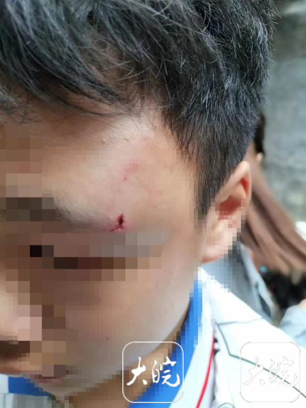 “男生被老师丈夫刺伤”，校方回应 男生被老师殴打