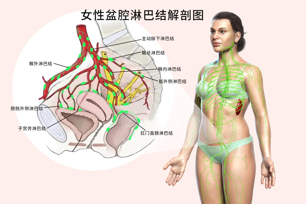 女性盆腔淋巴结解剖图（女性盆腔淋巴结图片结构图）