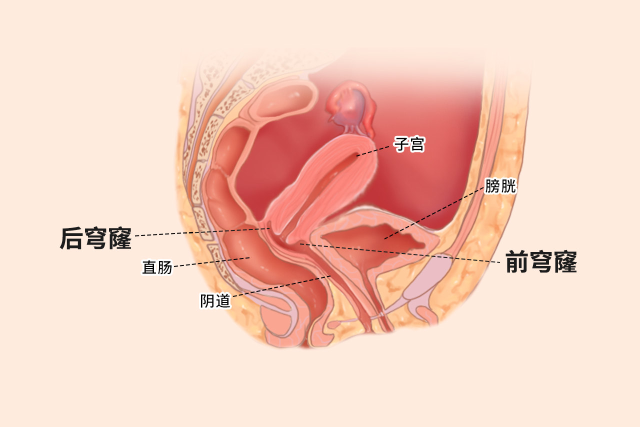 穹隆部位在哪里图片（穹隆部位是什么意思）