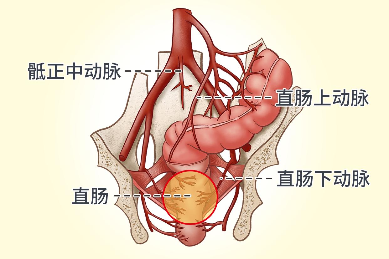 直肠动脉血供应图（直肠动脉血供应图 造影）