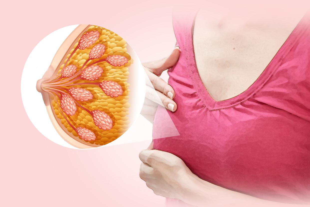 乳腺增生诊断书图片